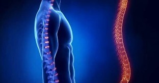 Osteochondrosis chrbtice