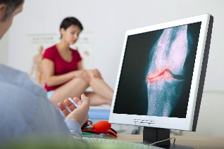 artróza diagnóza