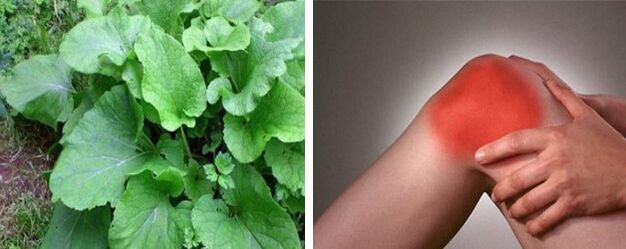 Výhody lopúcha pri artróze kolenného kĺbu